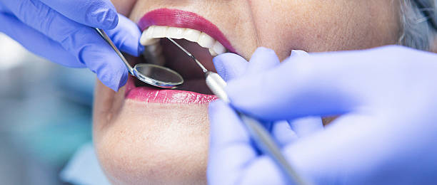 Best Emergency Dentist for Lost Fillings or Crowns in Pearland, TX